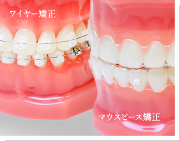 矯正歯科